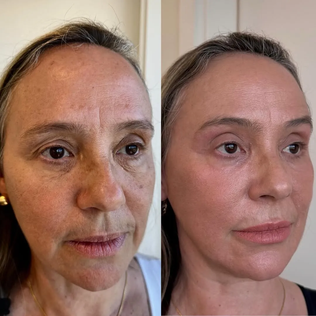 Antes e depois — resultado real 6