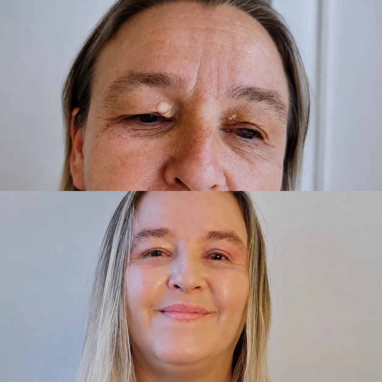 Antes e depois — resultado real 7