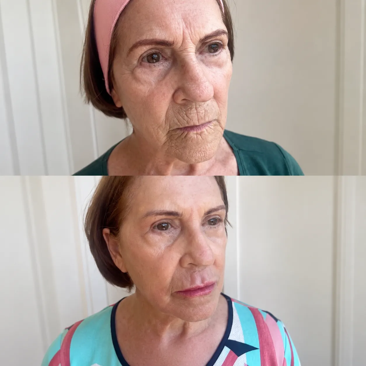 Antes e depois — resultado real 8